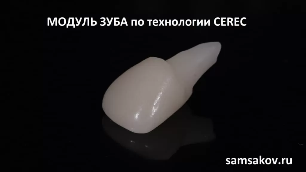 Так выглядит модуль зуба с корнем, выполненный по технологии Cerec. Время изготовления 10 минут. 