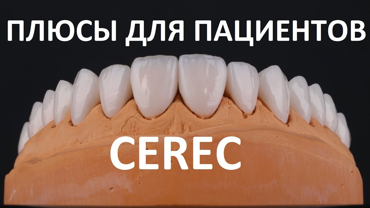 Плюсы технологии CEREC для пациента. Реставрация и восстановление зубов коронками и вкладками за час