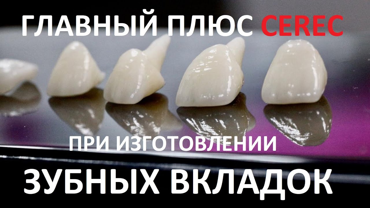 Вкладка в зуб CEREC - преимущества перед лабораторными зубными вкладками. Ортопед Самсаков Сергей