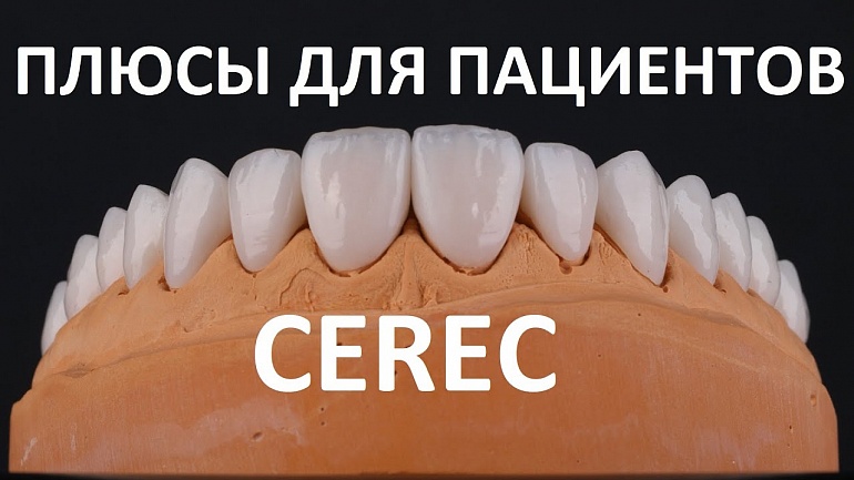 Плюсы технологии CEREC для пациента. Реставрация и восстановление зубов коронками и вкладками за час