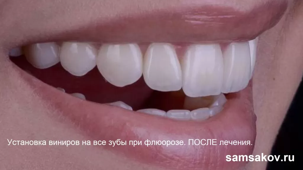 Как форма зубов может изменить вашу жизнь