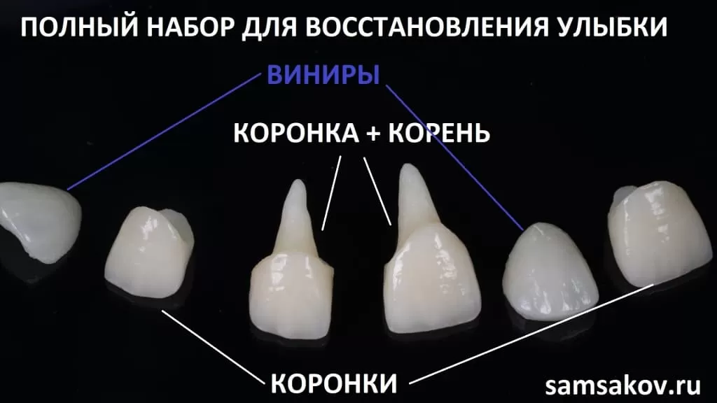 Коронки на зубы: металлокерамика – преимущества и недостатки, как ставят, стоимость