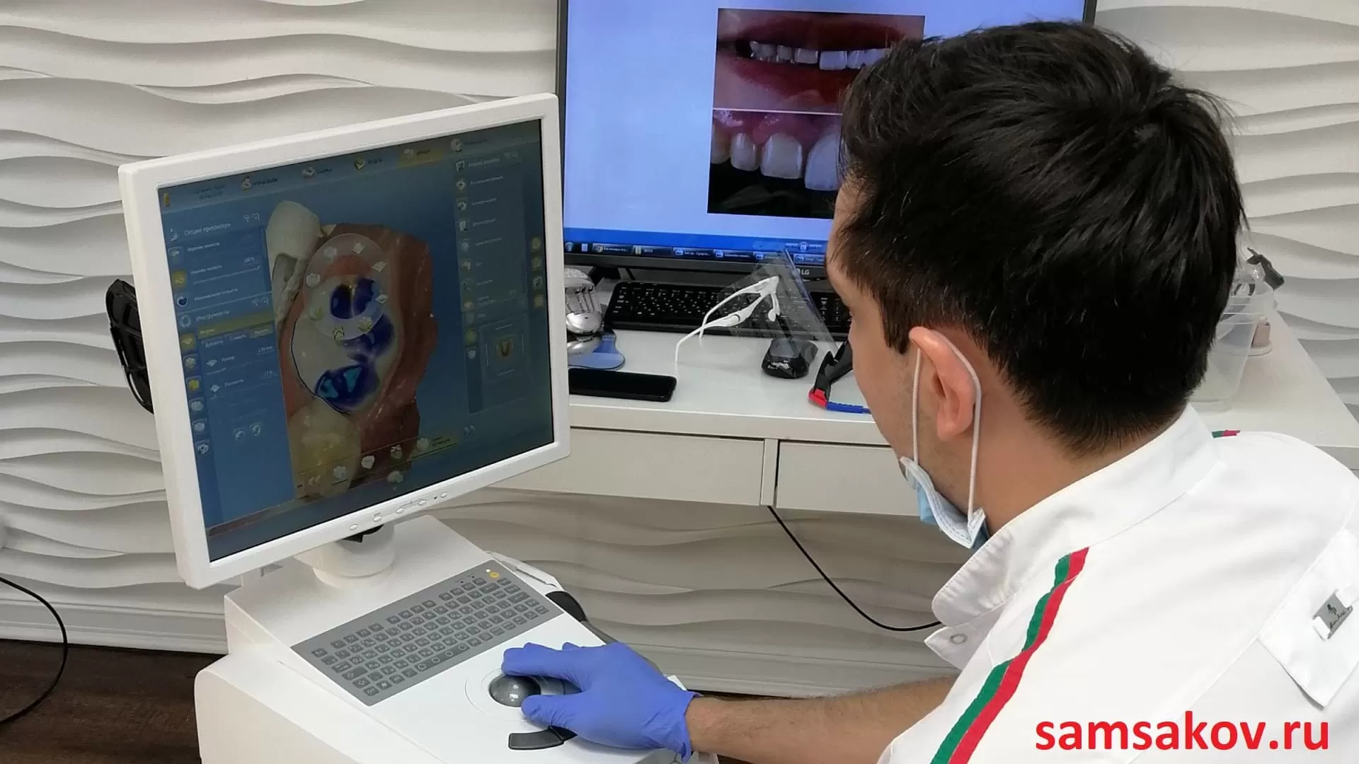 Сканирование зубов в 3D - безграничные возможности в стоматологии