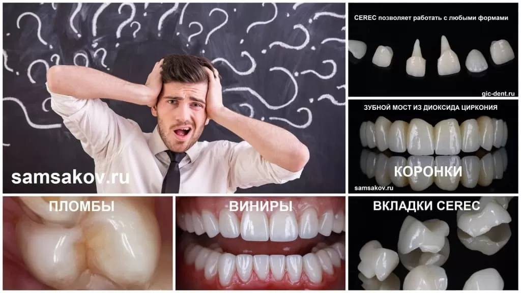 Восстановление переднего зуба виниром: можно ли замаскировать пломбу? Терапия или реставрация?