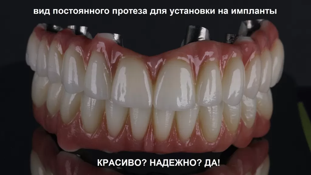 Идеальная улыбка в стоматологии: искусство имплантации зубов