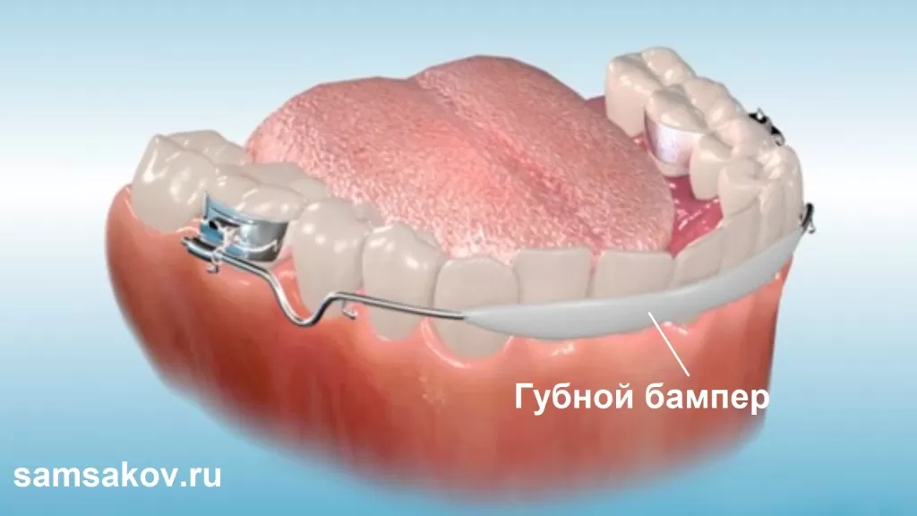 Бампер губной - комфортное и эффективное средство для защиты губ