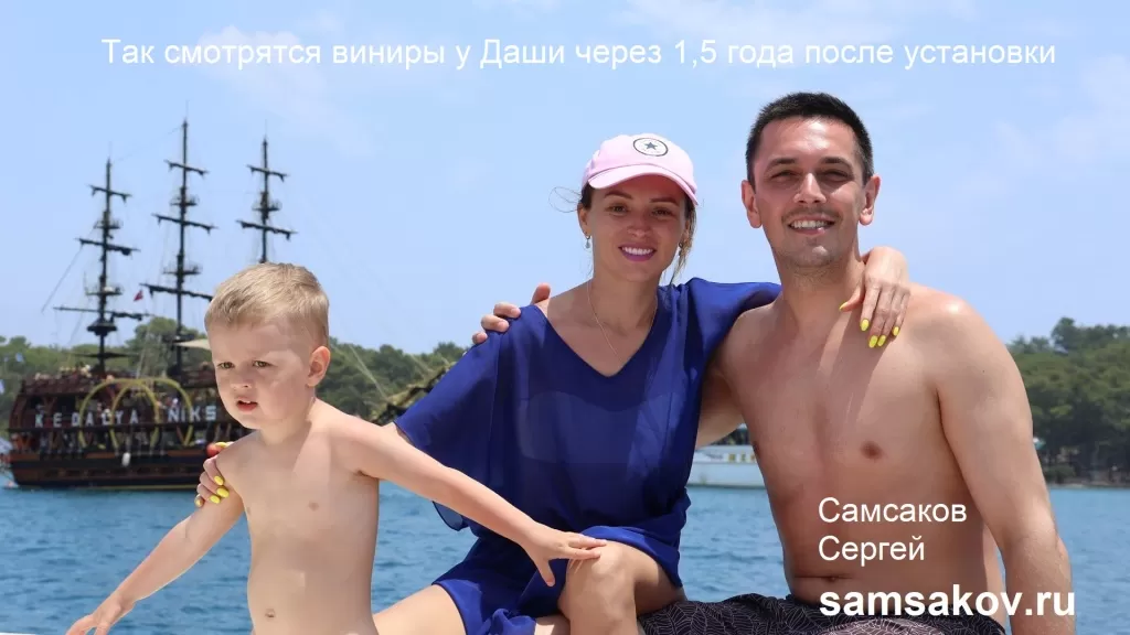 Фото виниров через 1,5 года с момента их установки. Сергей Самсаков на отдыхе с супругой Дарьей и сыном 