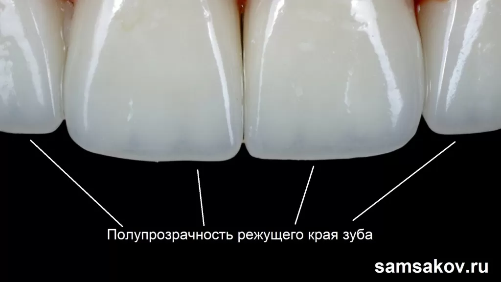 Прозрачность режущего края зуба очень красиво смотрится
