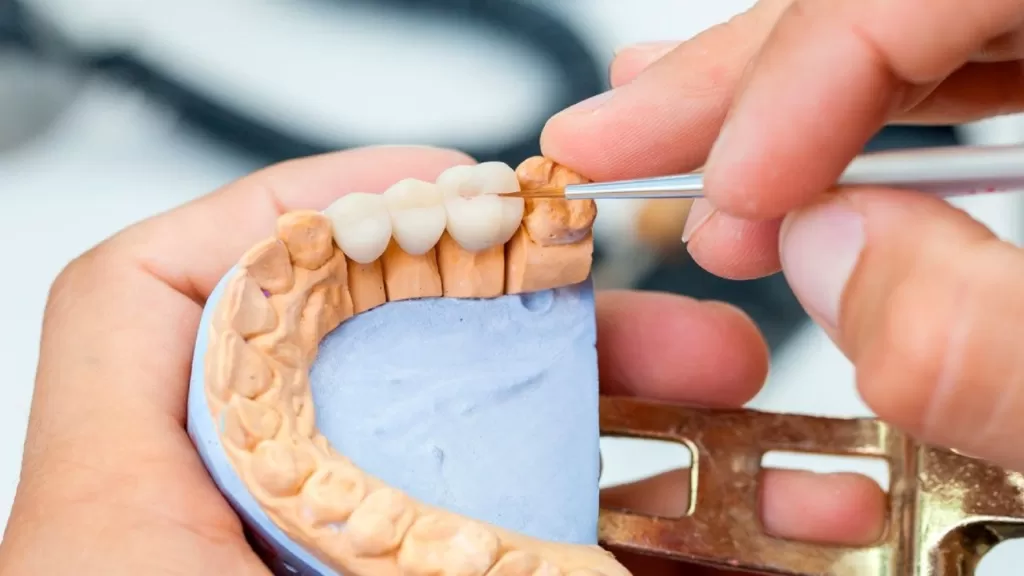 Восковое моделирование (Wax Up или вакс ап) - это процесс создания модели зубов или зубного протеза из специального стоматологического воска.
