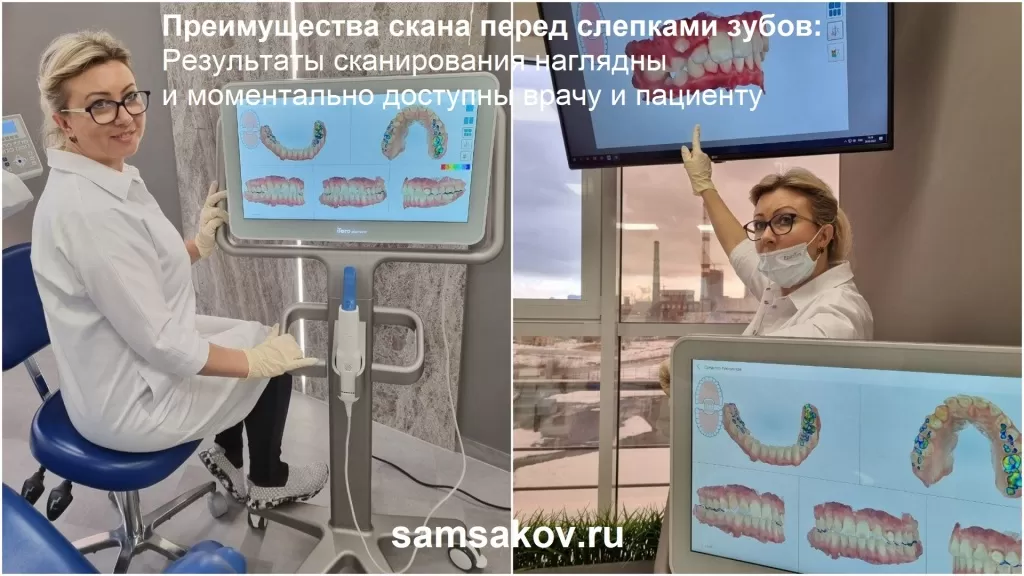 Результаты сканирования моментально доступны врачу и пациенту - к.м.н. Рягузова Е.Н. демонстрирует скан зубов пациенту