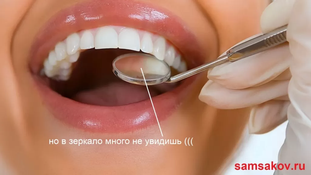 Лечить зуба только с использованием зеркала - очень неудобно
