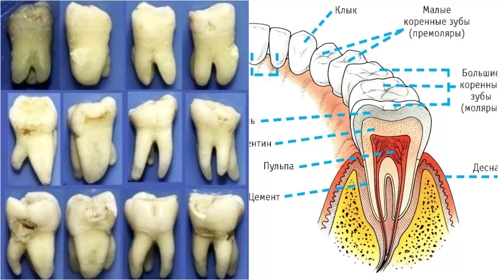 Виды седьмых зубов и особенности строения в срезе